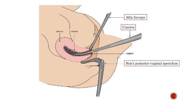 speculum placed posteriorly in vagina Male viberating sex toys